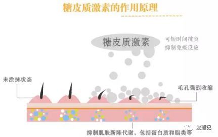 接触性皮炎的症状表现,化妆品接触性皮炎图片