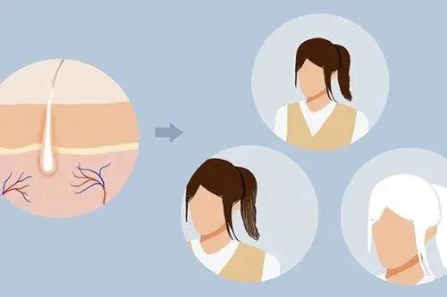 经常拔白头发会不会损伤毛囊,经常拔白头发会有什么后果