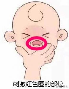 舌系带短与正常舌系带图片对比,舌系带短介绍