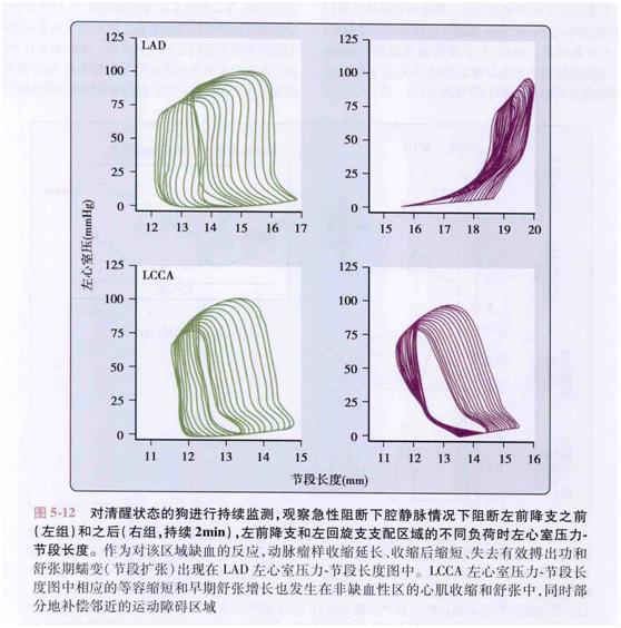 卡普兰教授的五本书,卡普兰治心衰新药