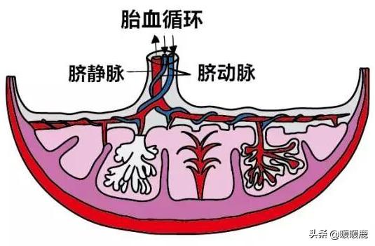 脐带绕颈几周会畸形,脐带扭转和脐带绕颈的区别
