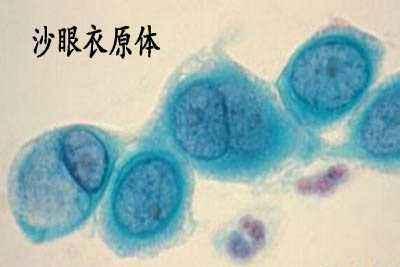 破坏人体生殖系统药物,破坏生育权触犯刑法