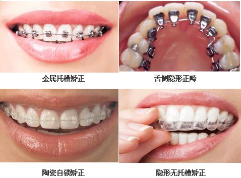 牙齿不齐磨平咋办,牙齿不齐不能矫正怎么办