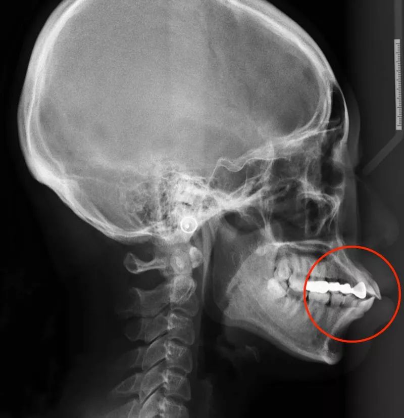 被嘴毁了的绝世容颜,被嘴耽误颜值