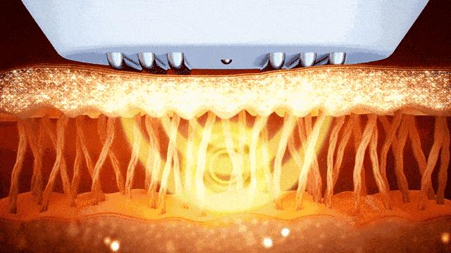 王鸥谈打了瘦脸针,王鸥打过瘦脸针吗