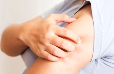 女性甲减是头顶和两边脱发严重吗,甲减脱发是因为缺铁还是因为睾酮