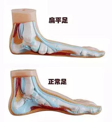 征兵体检前一天注意事项,征兵体检时有什么要注意的事项