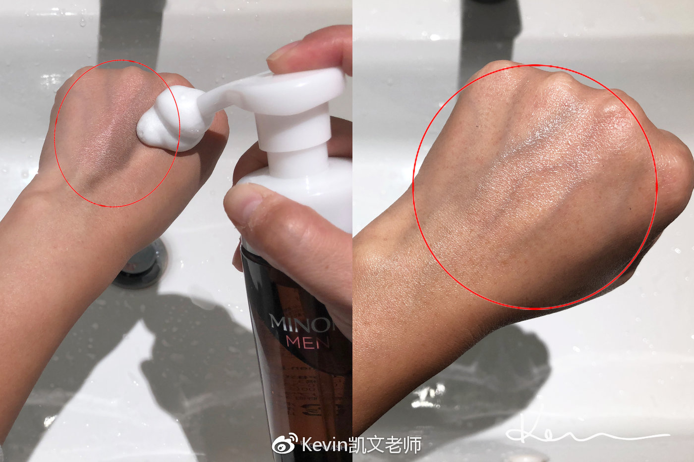 鏁忔劅鑲岀鐥樹竴濂楁姢鑲ゅ搧鎺ㄨ崘 (鏁忔劅鑲岀鐥樻姢鑲ゅ搧)