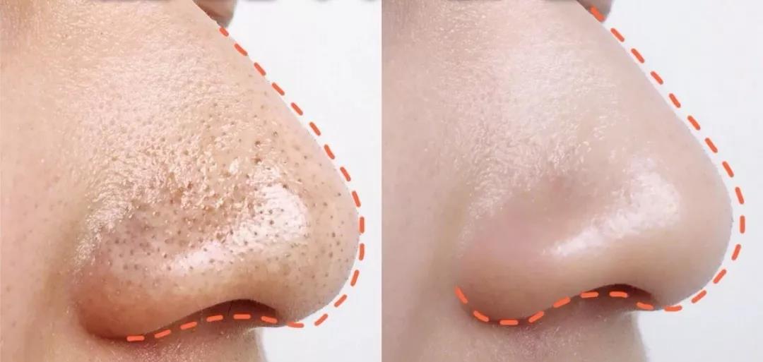 为啥用神仙水皮肤没有改善,神仙水皮肤越用越差