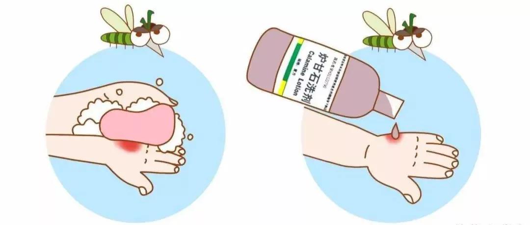 想不到！被蚊虫叮咬后，这几种药物能快速止痒