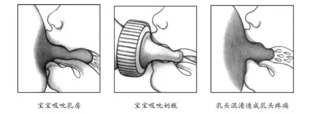 宝宝突然不吃妈妈乳头了？掌握这些技巧，让宝宝重新接受亲喂