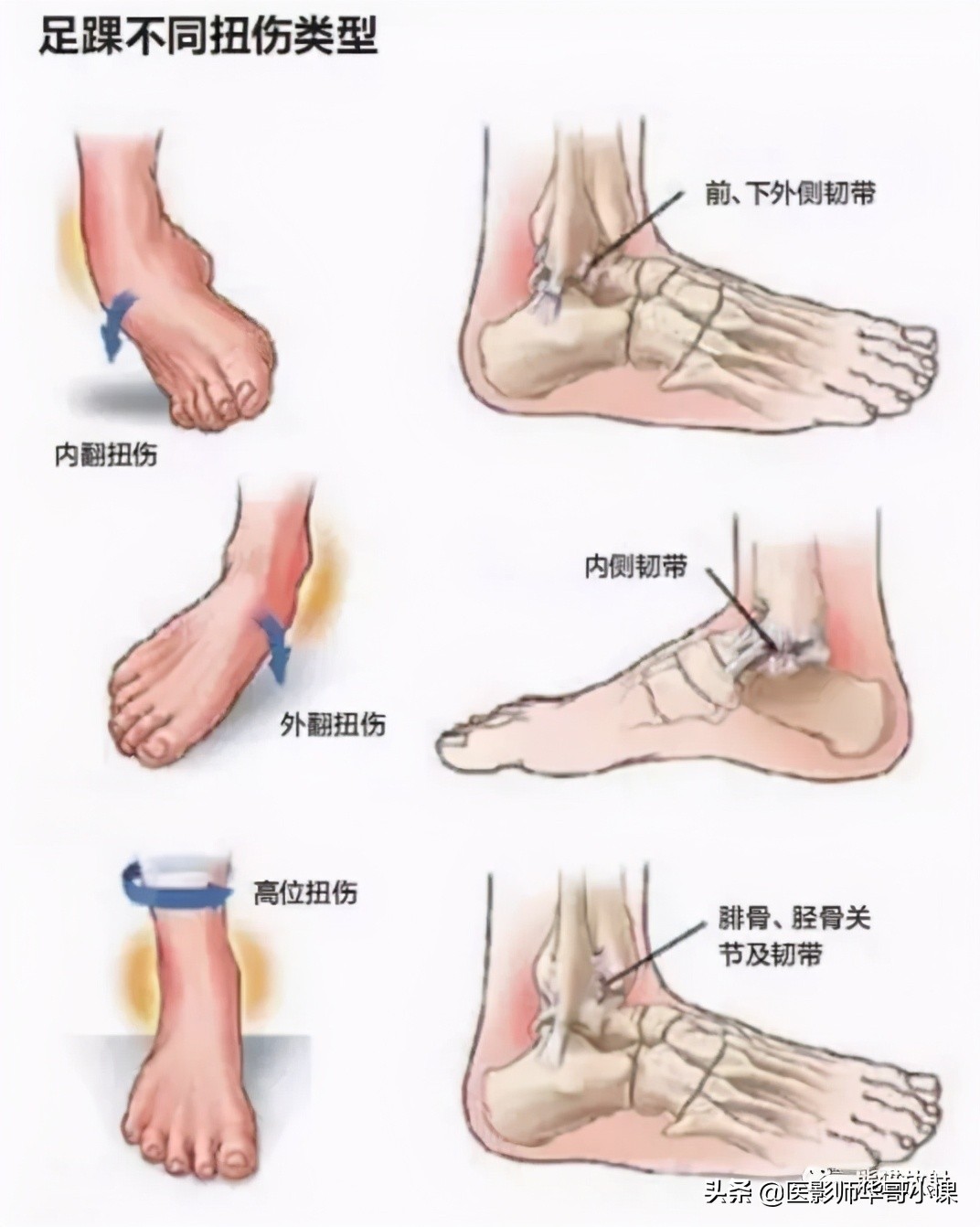 踝关节解剖视频课,解剖学韧带分布图