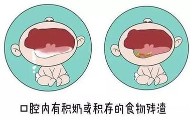宝宝的嘴巴很臭怎么回事,宝宝嘴巴太臭了怎么办