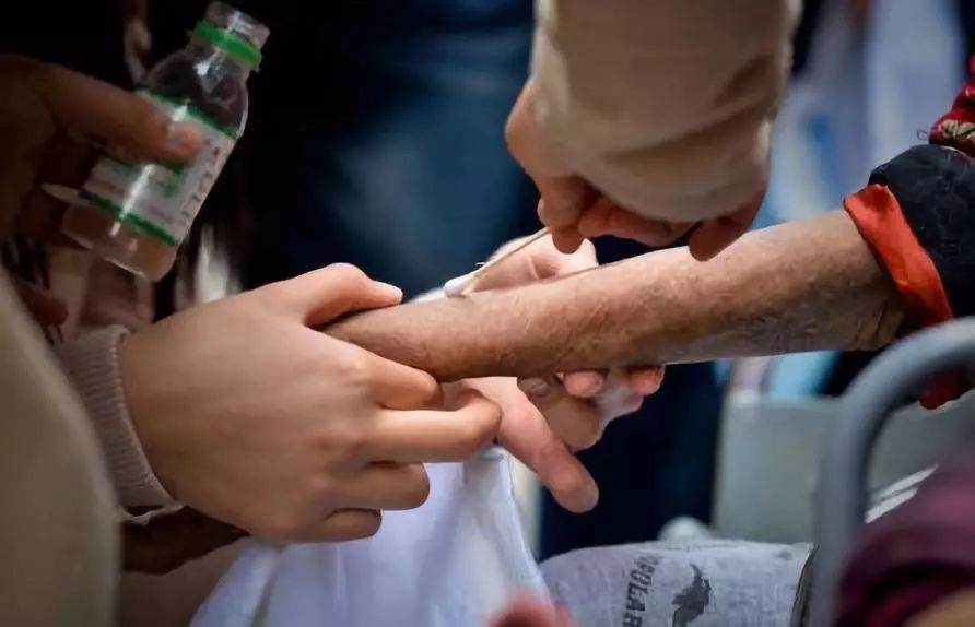 如何摆脱老寒腿,告别老寒腿护膝