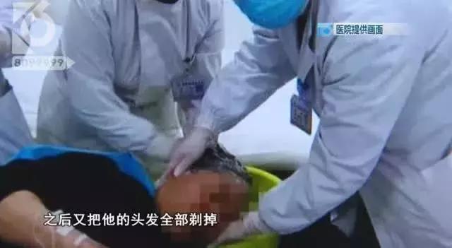 神操作!男子用敌敌畏洗头,医生“剃头”救命