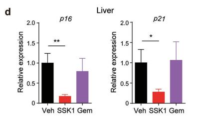 什么办法可以抗细胞衰老,如何抗糖化抗衰老