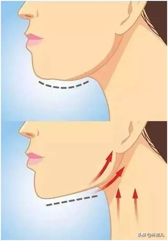 短方脸怎么修饰脸型,方脸瘦下去脸颊凹陷怎么办
