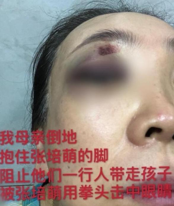 张培萌100米跑赢苏炳添,张培萌飞人事件