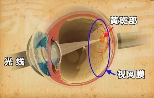 视力模糊眼底出血什么原因,视力下降中医病名