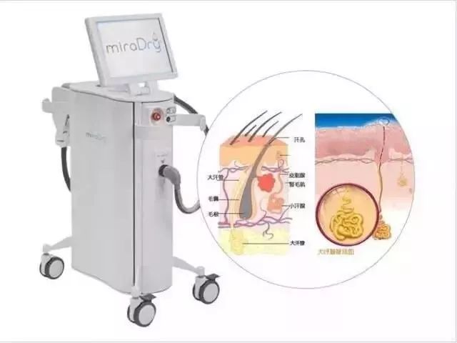 清新微波治疗腋臭一次的价格,清新微波治狐臭