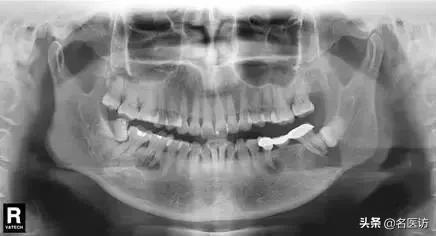 16位牙医自曝内幕看牙警惕哪些,牙医看牙时在想什么