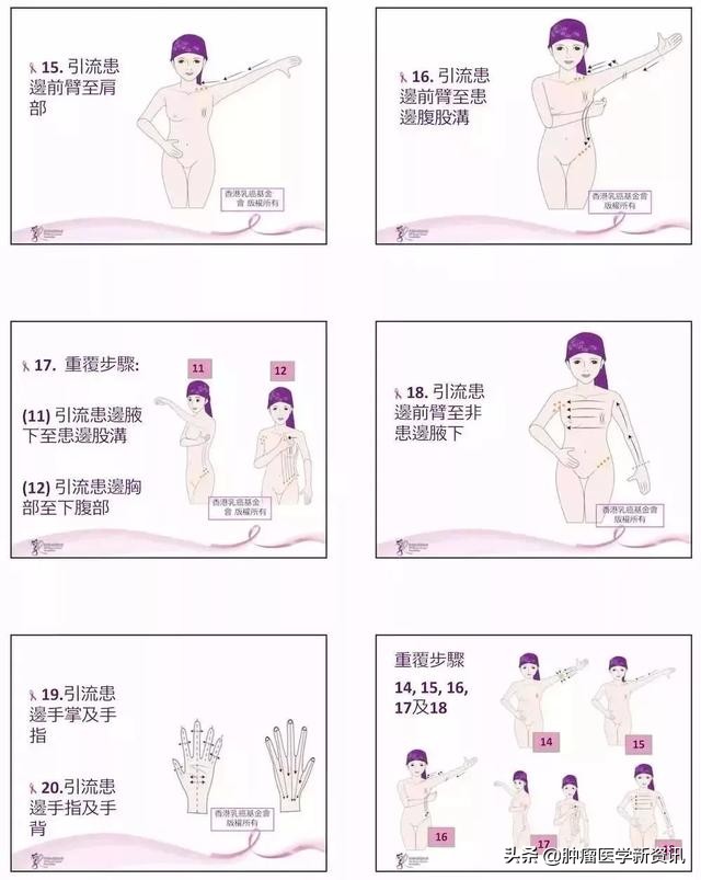 警惕！乳腺癌术后的淋巴水肿绝不能忽视