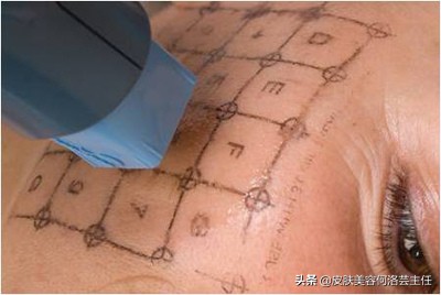 热玛吉有必要做么,热玛吉适用于什么人群