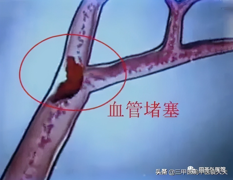 迈入中医之门第89篇：中医视角解读“疼痛论治”