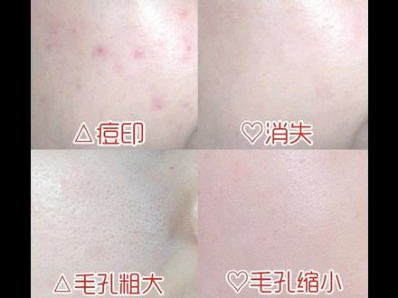 葡萄籽美白抗氧化,澳洲葡萄籽抗氧化吃几粒