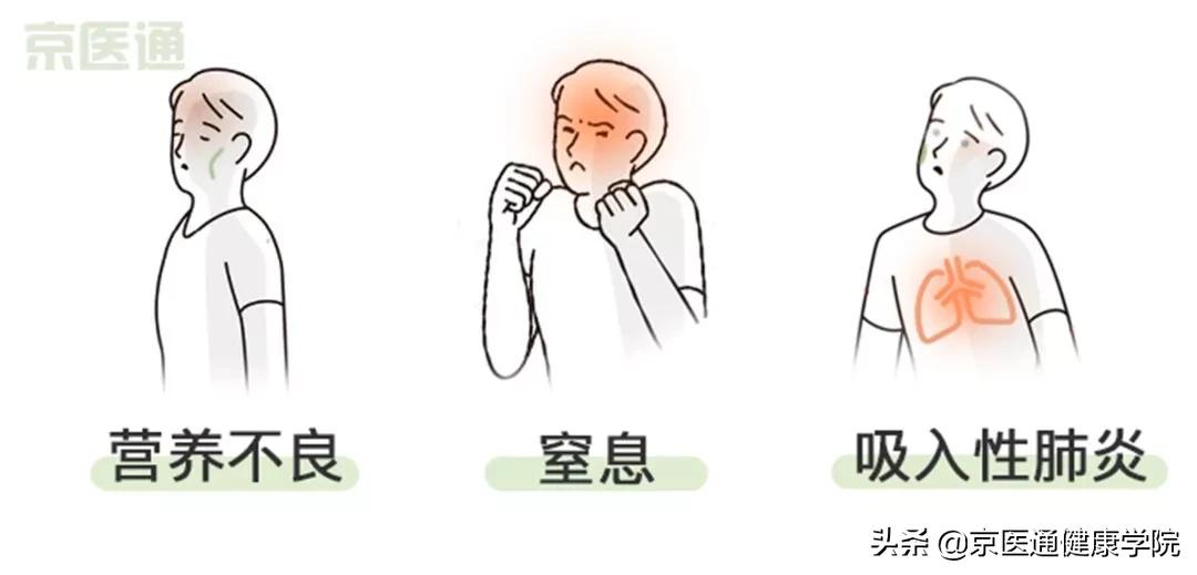 呛咳后吸入性肺炎怎么处理,吃饭老呛咳是什么病的前兆