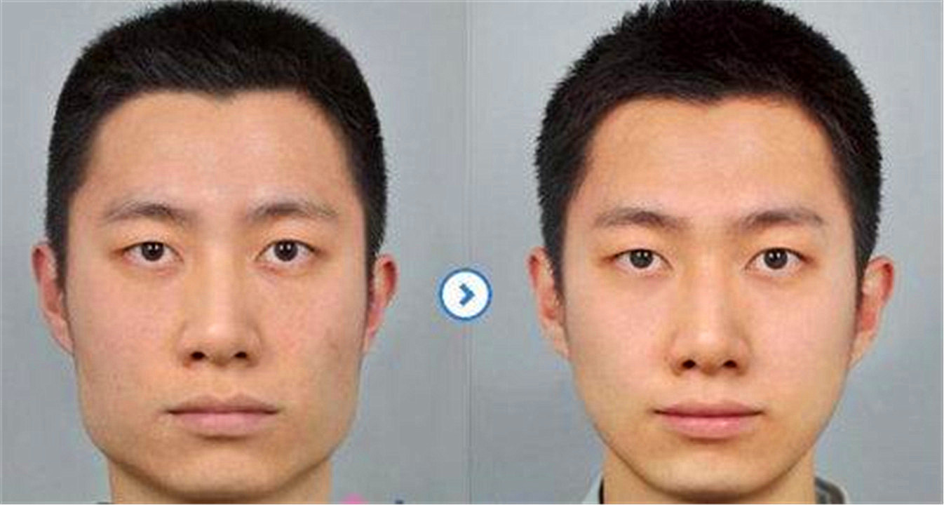 全国有多少人吃槟榔致癌,世界十大致癌物槟榔