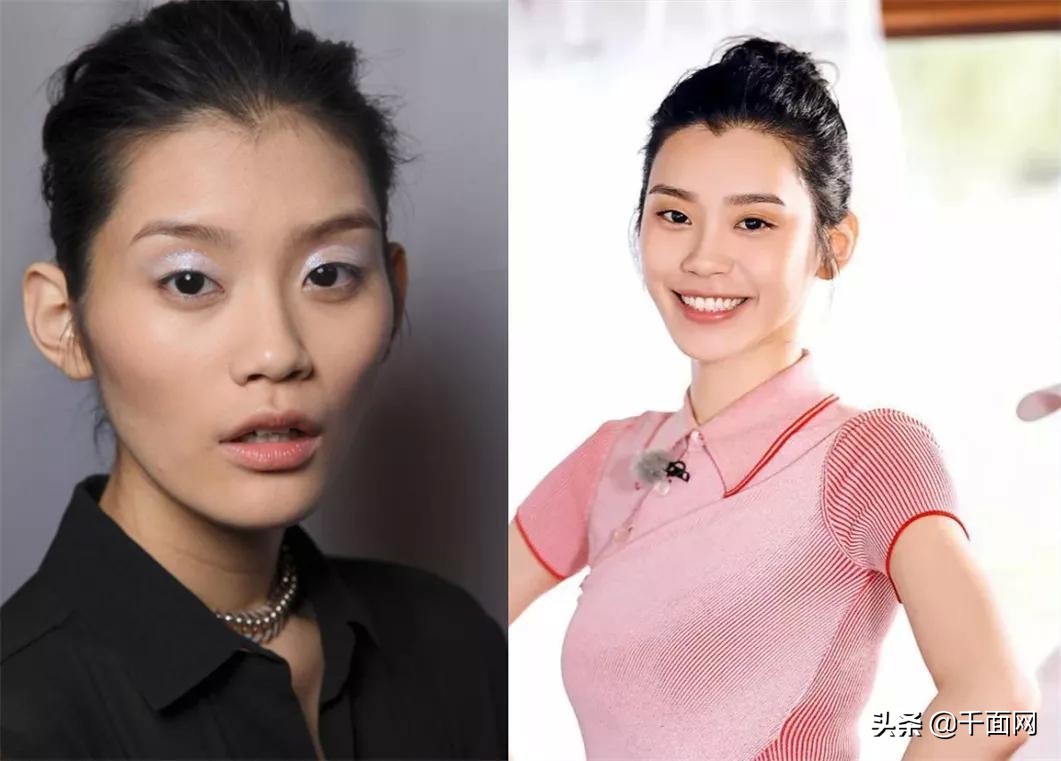 40多岁太阳穴凹陷填充,太阳穴凹陷填充分享