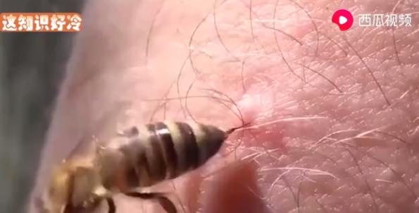 蜜蜂蜇完人留下的刺为什么在动,蜜蜂蜇完人后蜜蜂为什么会死视频