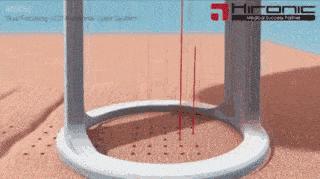 痘坑毛孔粗永久解决,毛孔大痘坑大粉底液遮不住怎么办