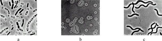 细菌的形态学观察实验原理,细菌的形态结构实验报告