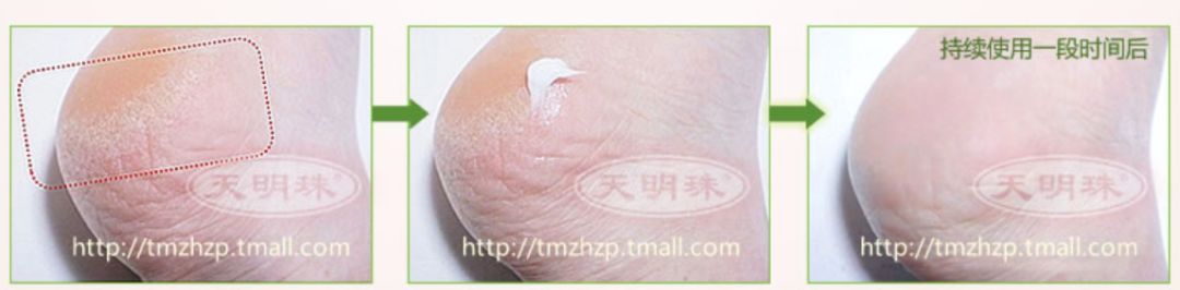 后脚跟干裂护足霜排行榜第一名,护脚霜脚后跟干裂修复霜国货