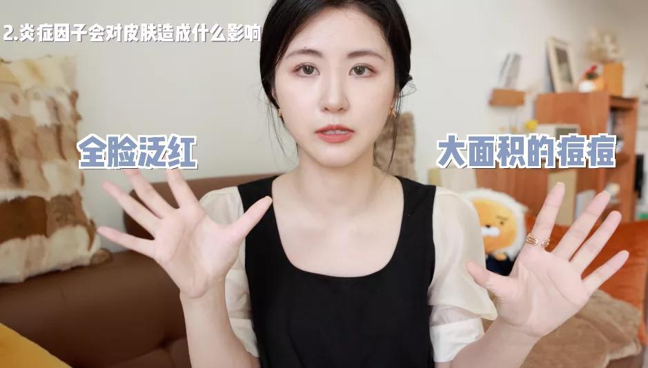 抗炎祛红痘痘,抗炎杀菌药膏痘痘