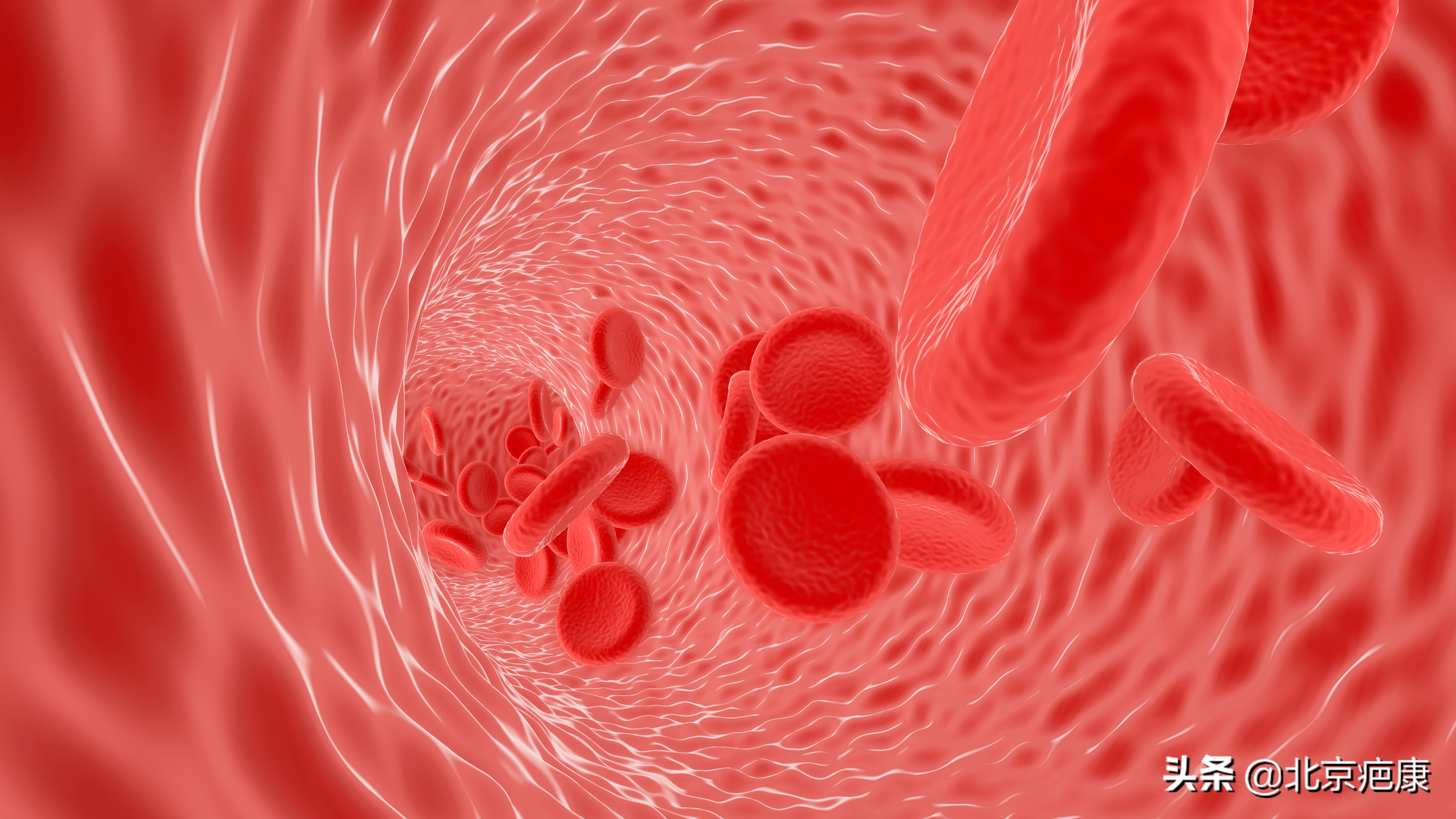 怎么判断瘢痕疙瘩是否复发,瘢痕疙瘩如何彻底治愈