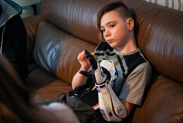 失去四肢的英国少年通过众筹，获《星球大战》仿生手臂得新生，