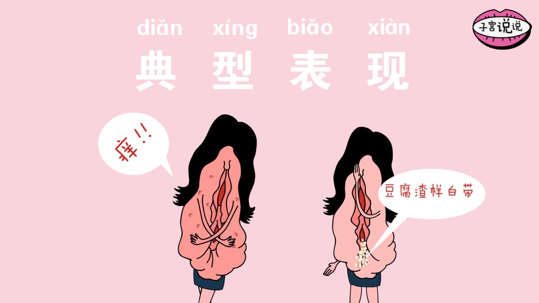 为什么会得霉菌性阴道炎，如何治疗？