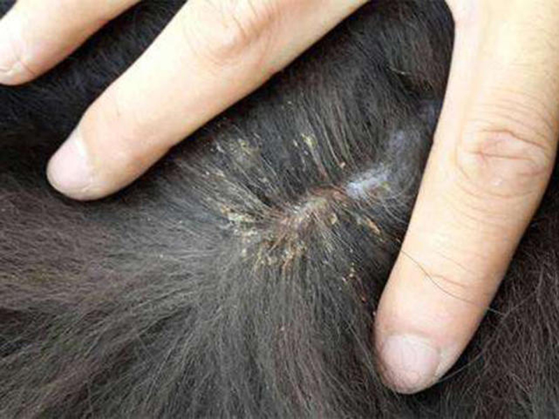 80年代农村为什么虱子多,为何30年前农村男女老少都有虱子