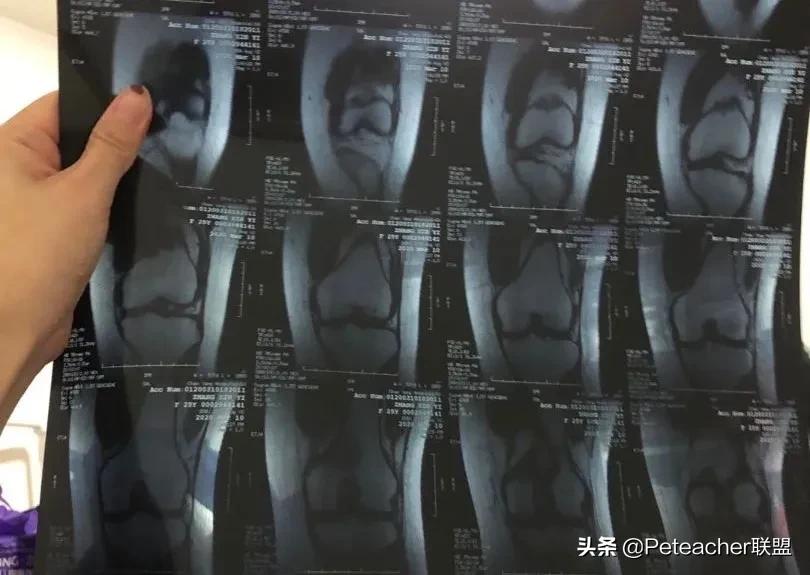 “因为跳了健身操,花了4w做手术的都市丽人,就是我。”