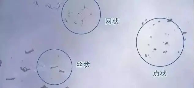 眼前有黑点飞蚊症,眼前有飞蚊症是怎么回事