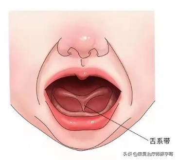 小孩说话不清楚咬舌头,孩子说话吐字不清剪舌系带吗