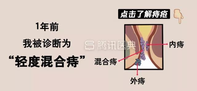 “*菊爆**后”痛到喊妈!真实看病经历泣血奉上,必须保护好菊花