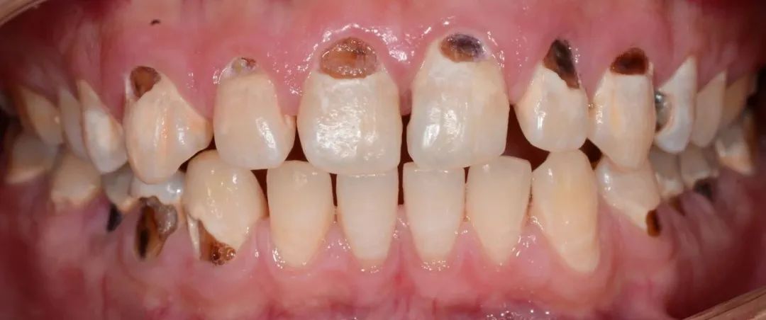 美白牙膏去牙黄真实有效测评,美白牙膏真实测评护牙效果