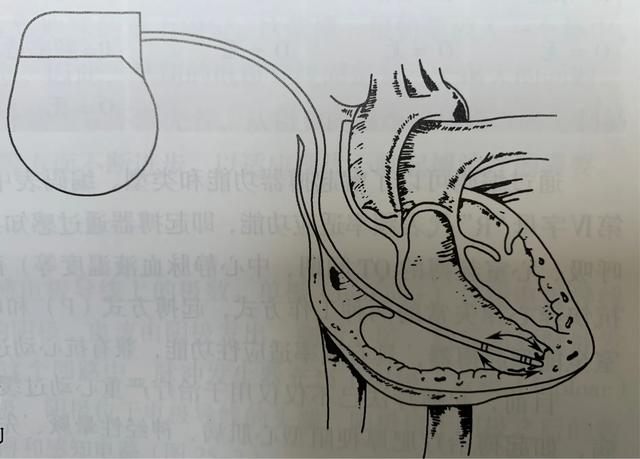 心率多少属于偏慢,成年男人正常心率偏慢