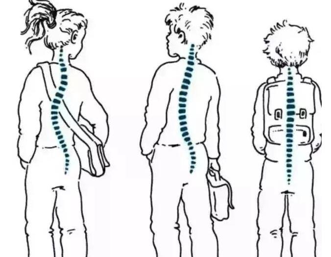 老年人脊柱歪了怎么办,成年人脊柱歪了的危害