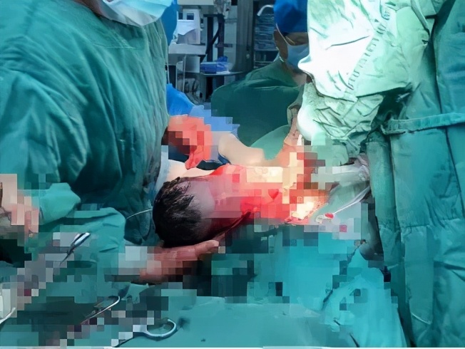 大理市第一人民医院顺产,大理第一人民医院产科