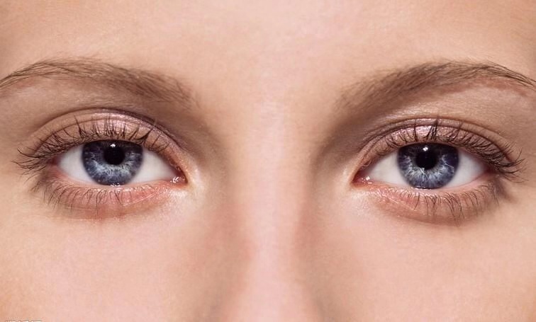 做双眼皮之后疤痕增生了怎么办,双眼皮预防疤痕增生用什么药